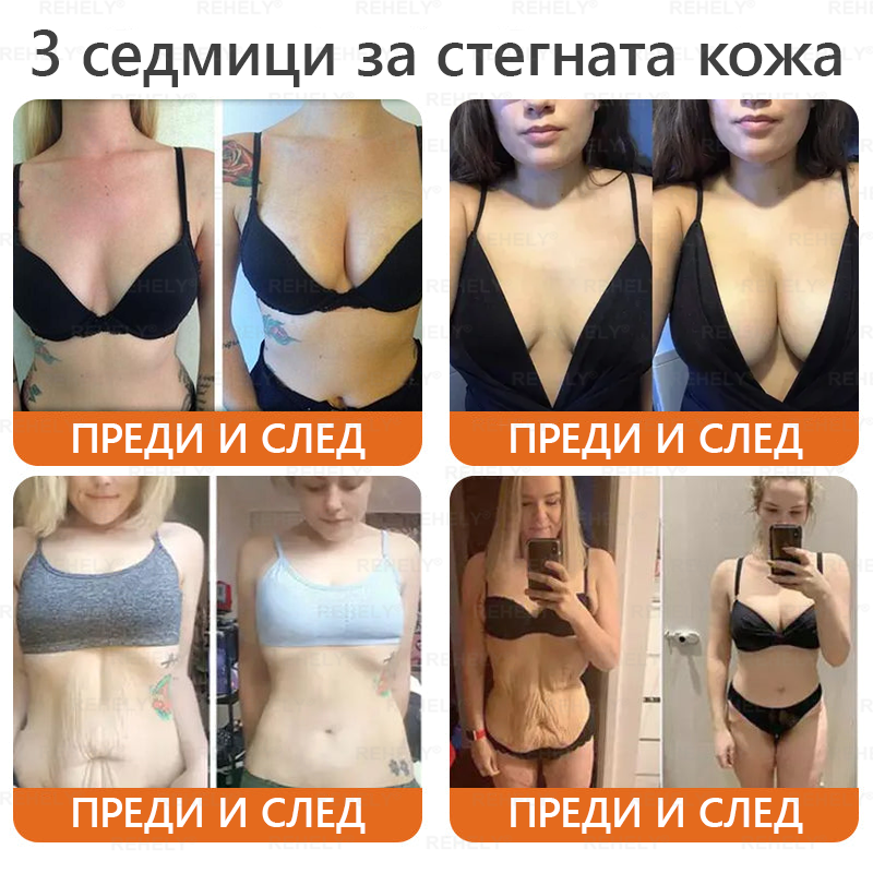 REHELY® Крем с пчелна отрова за регенерация на кожата – ✨Подходящ за всички възрасти и типове кожа