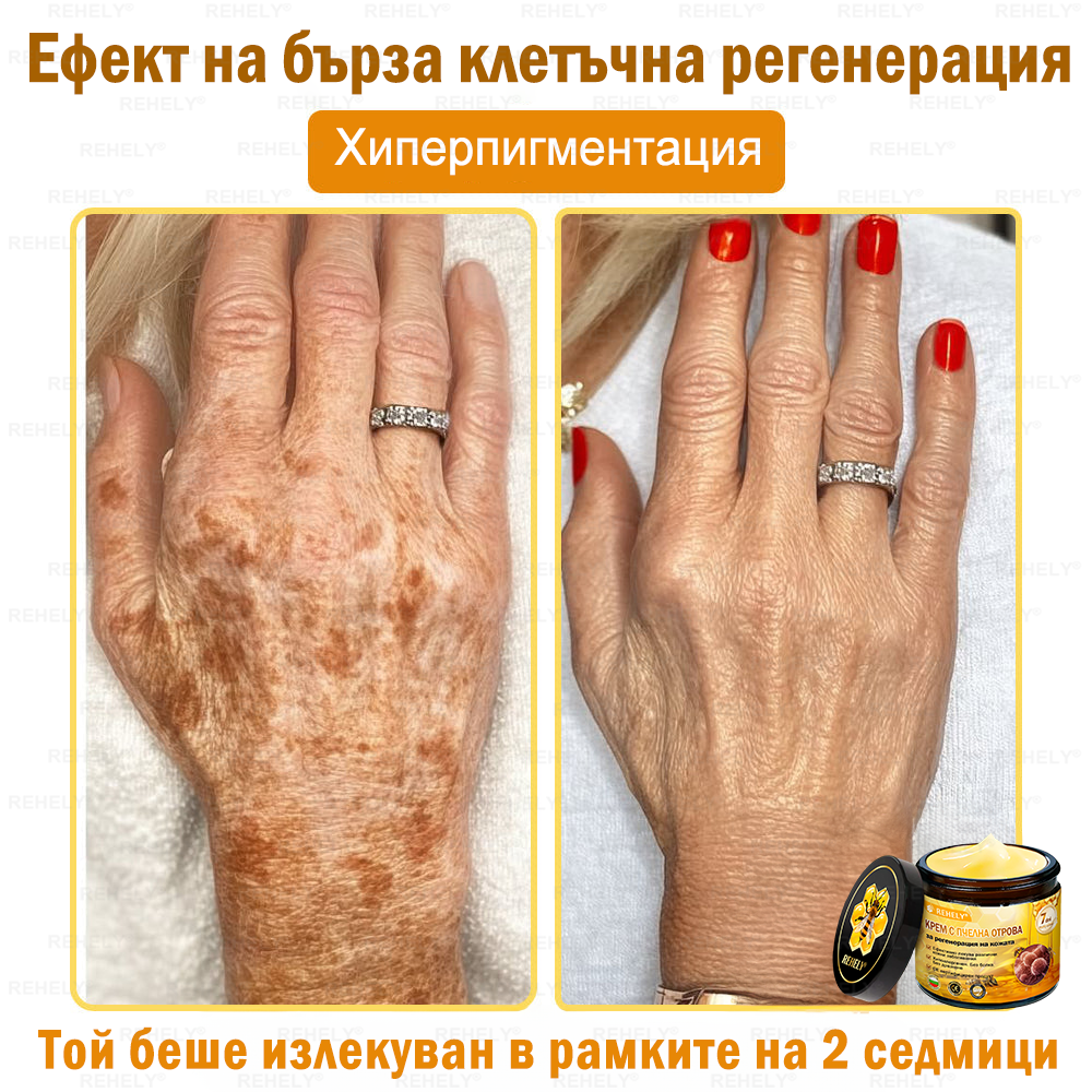 🎉 Честито! Вие сте нашият щастлив клиент за днес! ✨🎁 Само сега – получавате допълнителна отстъпка от -50%! ✨ Не се колебайте – специалната оферта на REHELY® е валидна само днес и няма да се повтори скоро!