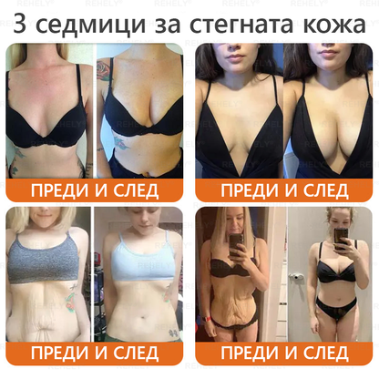 🎉 Честито! Вие сте нашият щастлив клиент за днес! ✨🎁 Само сега – получавате допълнителна отстъпка от -50%! ✨ Не се колебайте – специалната оферта на REHELY® е валидна само днес и няма да се повтори скоро!