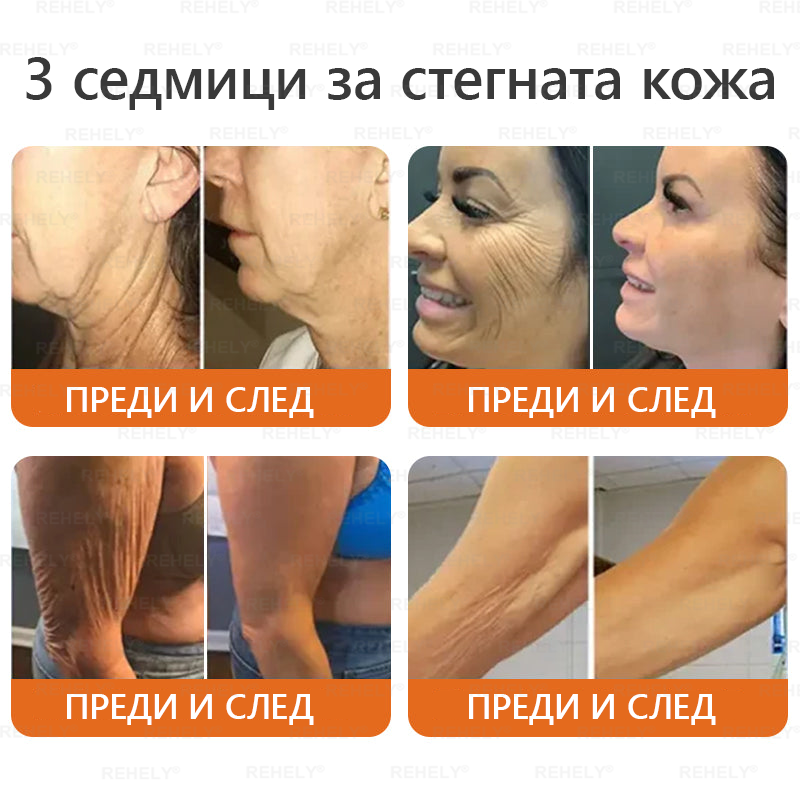 🎉 Честито! Вие сте нашият щастлив клиент за днес! ✨🎁 Само сега – получавате допълнителна отстъпка от -50%! ✨ Не се колебайте – специалната оферта на REHELY® е валидна само днес и няма да се повтори скоро!