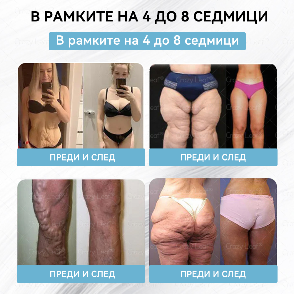 CrazyLeaf® Slim & Vitality Tirzepatide – орален разтвор, който подкрепя отслабването, кръвното налягане и нивата на захар