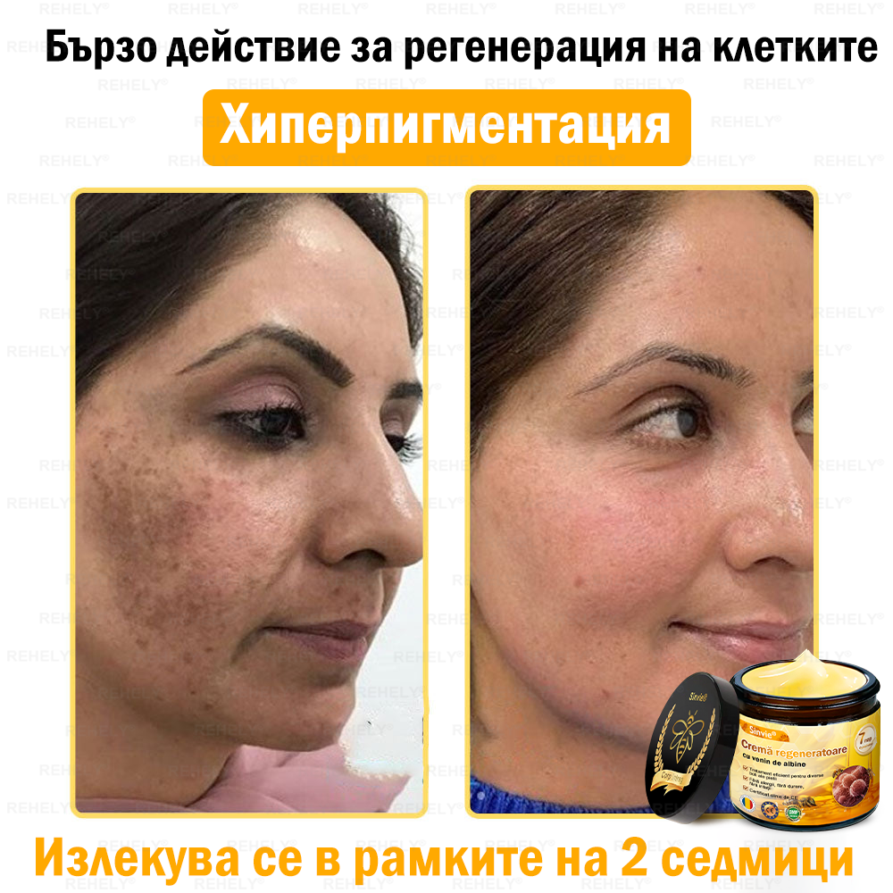 🎉 Честито! Вие сте нашият щастлив клиент за днес! ✨🎁 Само сега – получавате допълнителна отстъпка от -50%! ✨ Не се колебайте – специалната оферта на REHELY® е валидна само днес и няма да се повтори скоро!