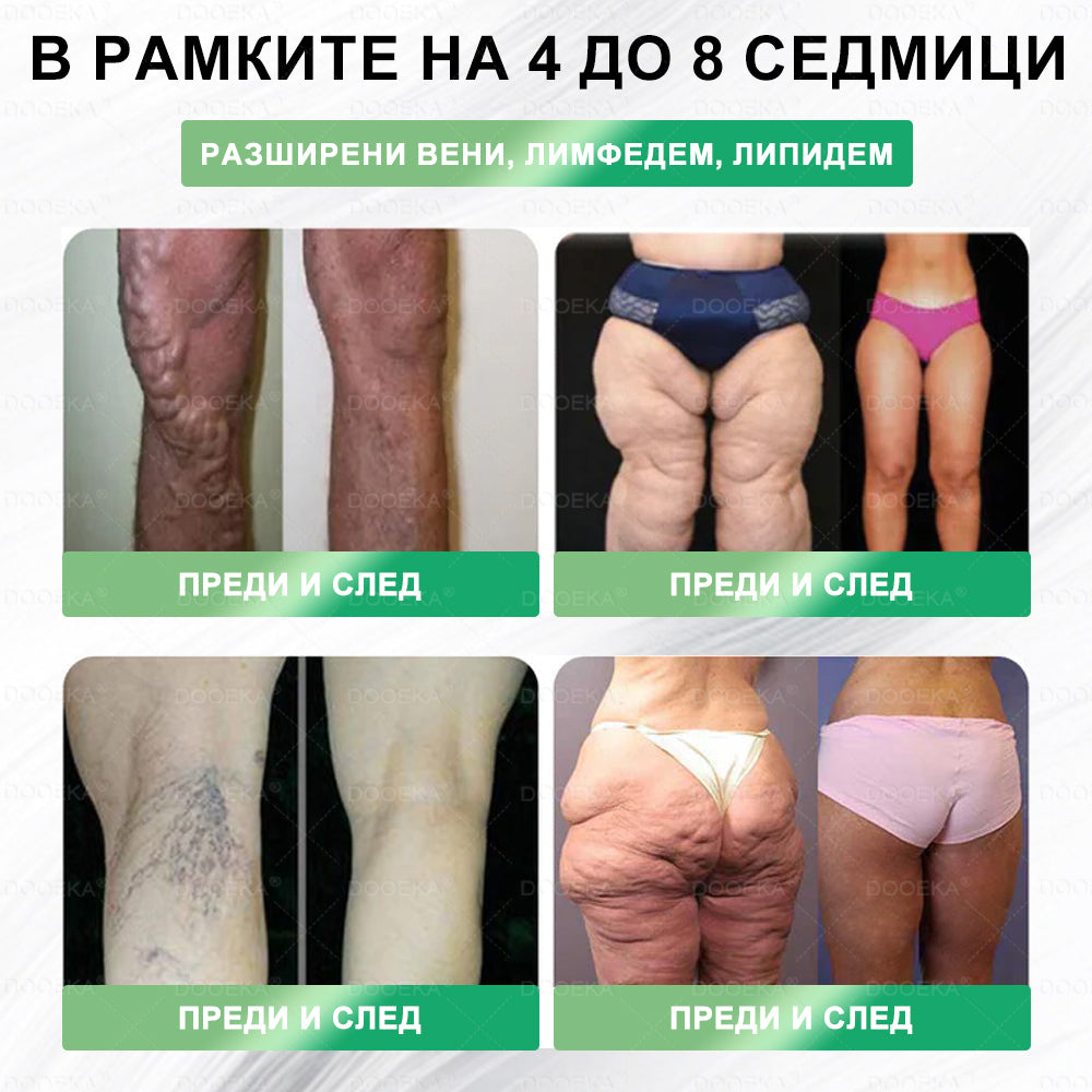 DOOEKA® 🎉 Честито! Днес вие сте нашият късметлийски клиент! 💖 Само днес – грабнете допълнителна отстъпка от -50%! Не се колебайте – следващата такава възможност може да дойде чак догодина! 🔥